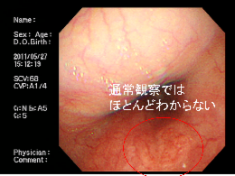 https://shibuya-ichou-clinic.com/grit/wp-content/uploads/2024/08/post_1067-8.png