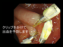 https://shibuya-ichou-clinic.com/grit/wp-content/uploads/2024/08/post_1086-3.png